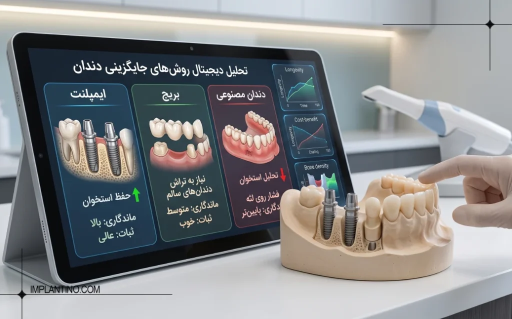 مقایسه ایمپلنت چند دندان با دندان مصنوعی و بریج؛ کدام روش بهتر است؟ 34 مقایسه ایمپلنت 5
